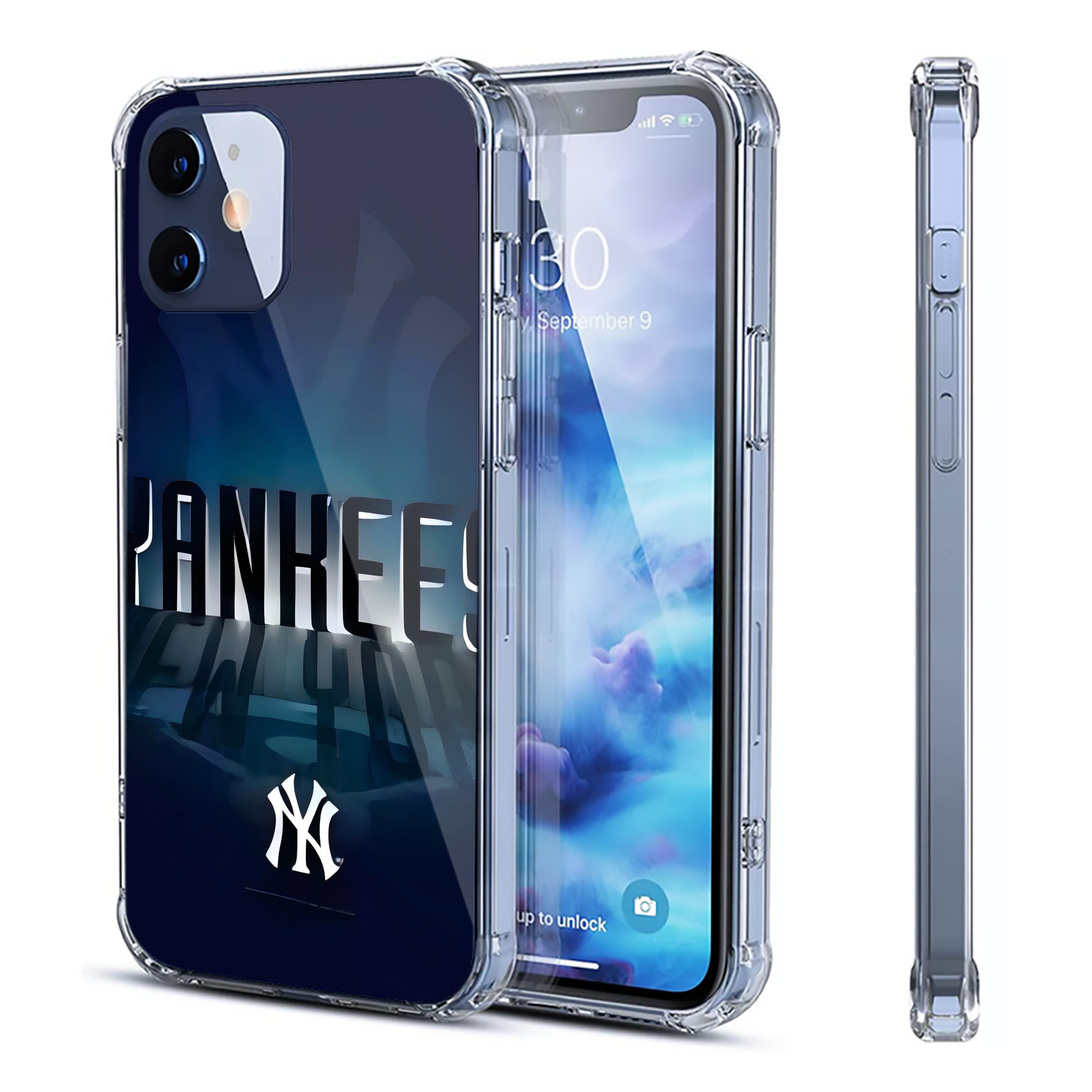New York Yankees 160 Clear IPhone 12 Case – Soft TPU With UV Print – Enhanced Drop Protection, Precise Fit, Anti-Fingerprint, Customizable Design, Scratch-Resistant, Yellow-Resistant